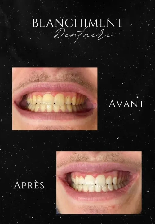 Image de galerie n°4